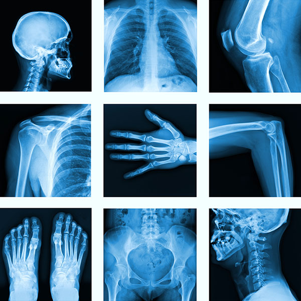 Radiology Ml Experts Consulting